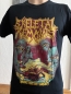 Preview: SKELETAL REMAINS (us) - Reconstructive Surgery - T-SHIRT