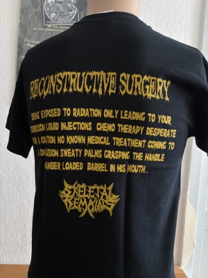 Preview: SKELETAL REMAINS (us) - Reconstructive Surgery - T-SHIRT