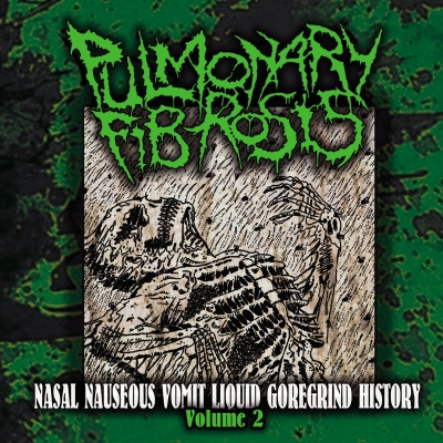 PULMONARY FIBROSIS (fr) - Nasal Nauseous Vomit ... - CD